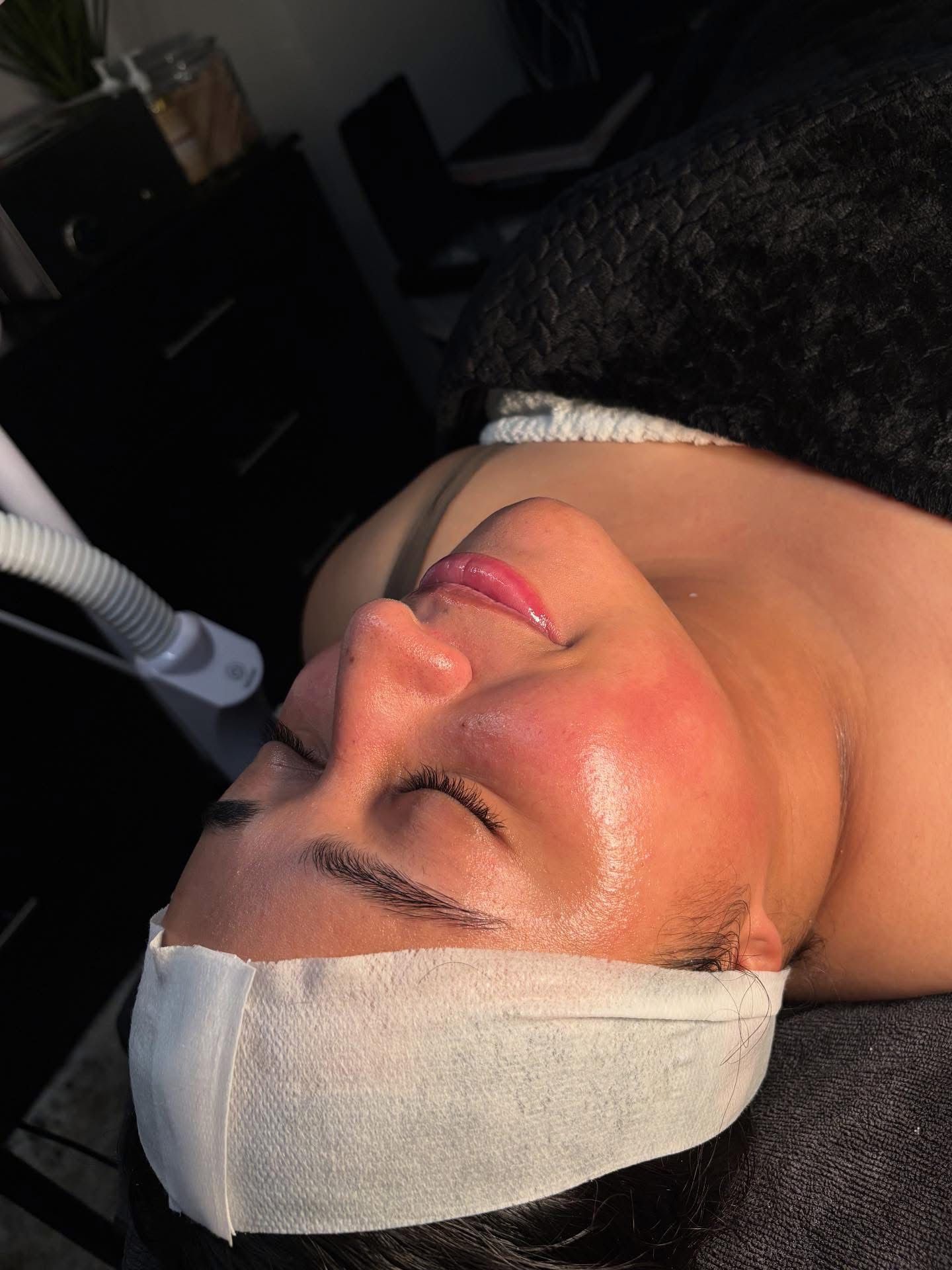 Brightening facial for hyperpigmentation
